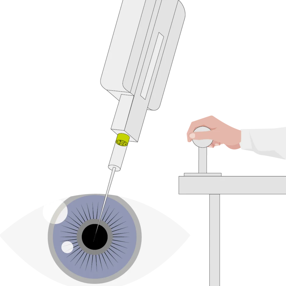 Surgical robot end effector interacting with eye while operator controls system at console