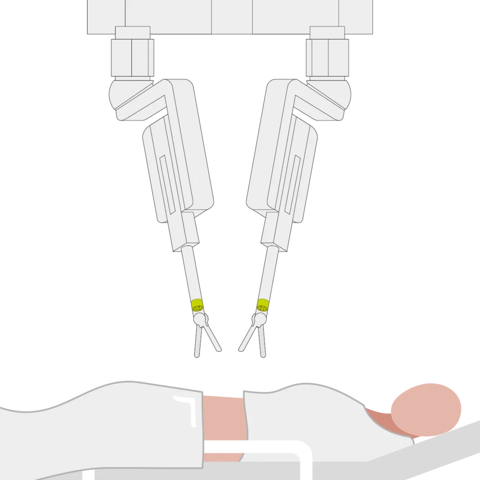 Illustration of minimally invasive surgical instruments with integrated sensing at the distal ends, enabling force feedback and supporting precise, controlled manipulation during procedures